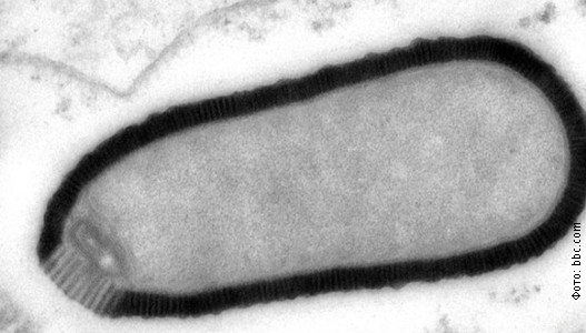 Virus